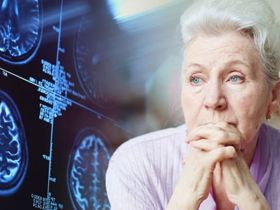Những dấu hiệu cảnh báo bệnh Alzheimer - Người bệnh cần lưu ý!